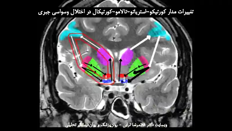 نوروساینس و نوروآناتومی وسواس OCD